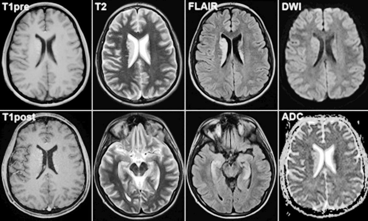 МРТ головы в СПб – все, что нужно знать про МРТ головного мозга