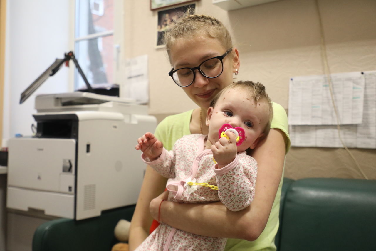 В Петербурга врачи продолжают спасать девочку с огромным родимым пятном 